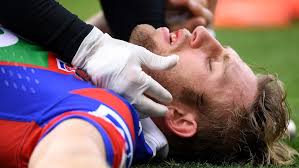 खेल के मैदान पर 'कन्कशन' (Concussion/सिर की चोट) की तुरंत पहचान और 24-घंटे का प्रोटोकॉल