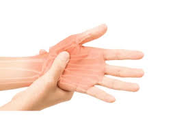 टेंडन ट्रांसफर सर्जरी (Tendon Transfer): लकवाग्रस्त हाथ में दूसरी मांसपेशी लगाकर मूवमेंट वापस लाना
