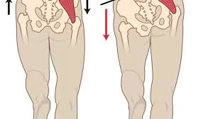 ट्रेंडेलनबर्ग चाल (Trendelenburg Gait): कूल्हे की मांसपेशी (Gluteus Medius) कमजोर होने पर लंगड़ाकर चलना