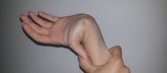 डबल जॉइंटेड (Double Jointed) उंगलियों या कोहनी को उल्टा मोड़ने वाले लोगों का रहस्य (Hypermobility)।
