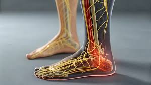 डायलिसिस के मरीजों (CKD) में रेस्टलेस लेग सिंड्रोम (RLS) और पैरों की भयंकर बेचैनी के व्यायाम