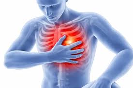 पसलियों (Ribs) के खिसकने (Rib Subluxation) के कारण सीने में होने वाला दर्द (जिसे लोग अक्सर हार्ट अटैक समझ लेते हैं)