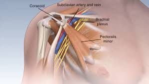 पेक्टोरल माइनर (Pec Minor) यह छाती की मांसपेशी आपके कंधों को आगे की तरफ क्यों झुका रही है (Rounded Shoulders)