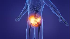 पेल्विक टिल्ट (Anterior Pelvic Tilt): पेट बाहर और कूल्हे पीछे निकालकर खड़े होना लोअर बैक पेन का सबसे बड़ा कारण