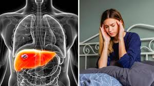 फैटी लिवर (Fatty Liver) के मरीजों के लिए कोर और पेट की चर्बी घटाने वाले क्लिनिकल व्यायाम