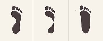 फ्लैट फीट (Flat Feet) 'वेट फुटप्रिंट' (Wet Footprint) टेस्ट से जानें आपके तलवे चपटे हैं या नहीं।