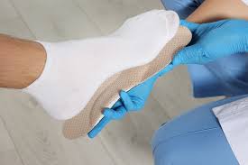 वजन ज्यादा होने पर पैरों के आर्च (Flat Foot) के गिरने का बायोमैकेनिकल विश्लेषण और इनसोल (Insoles)