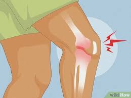 सीढ़ियां चढ़ते समय 'घुटने से कटकट की आवाज' आना: क्रेपिटस (Crepitus) कब सामान्य है और कब खतरनाक?