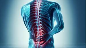 स्पाइन सर्जरी स्लिप डिस्क के ऑपरेशन से पहले कोर मसल्स को एक्टिवेट कैसे करें।