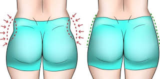 हिप डिप्स (Hip Dips) कूल्हे के साइड के गड्ढे—क्या यह कोई बीमारी है या सिर्फ प्राकृतिक शारीरिक बनावट