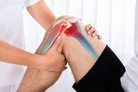 एसीएल (ACL) टियर लिगामेंट सर्जरी के बाद खेल के मैदान (Return to Sport) में वापसी के मापदंड।