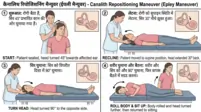  कैनालिथ रिपोजिशनिंग मैन्युवर
