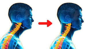 चिन टक (Chin Tuck) 1 मिनट में सर्वाइकल पोस्चर को सीधा करने का व्यायाम।