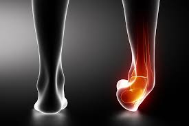 टखने की मोच (Ankle Sprain) लिगामेंट इंजरी के बाद बार-बार मोच आने से रोकने के लिए बैलेंस बोर्ड ट्रेनिंग