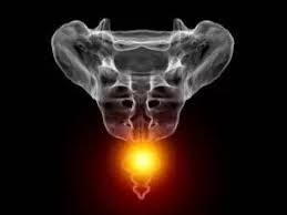 टेलबोन मोबिलाइजेशन फर्श पर जोर से गिरने के बाद पूंछ की हड्डी (Coccyx) के दर्द का एडवांस क्लिनिकल इलाज।