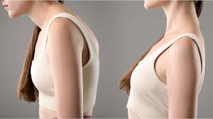 पोस्चर करेक्शन गोल कंधों (Rounded Shoulders) को सीधा करने के लिए 'चिन टक' (Chin Tuck) और स्कैपुलर रिट्रैक्शन।