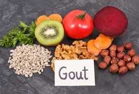 यूरिक एसिड (Uric Acid) और गाउट क्या सिर्फ डाइट काफी है या जोड़ों की अकड़न रोकने के लिए फिजियो भी जरूरी है?