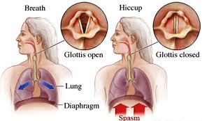 हिचकी (Hiccups) और डायाफ्राम बार-बार हिचकी आने पर डायाफ्राम की नस को रिलैक्स करने की फिजियो तकनीक।