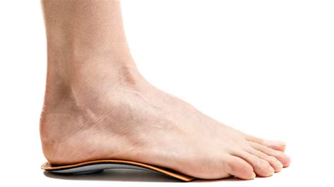 फ्लैट फुट (Flat Feet) वाले लोगों के लिए ऑर्थोपेडिक जूतों (Orthopedic Shoes) की आवश्यकता