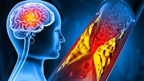 स्ट्रोक (Stroke) के मरीजों में संतुलन और गिरने से बचाव (Fall Prevention) के लिए रिहैब