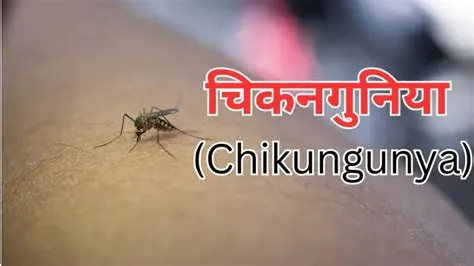 चिकनगुनिया (Chikungunya)