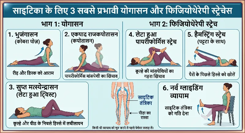 साइटिका के लिए 3 बेस्ट योगासन और फिजियोथेरेपी स्ट्रेचेस