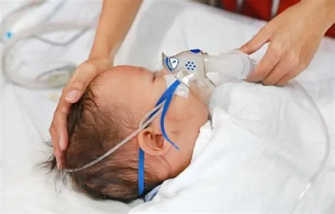 एक्यूट रेस्पिरेटरी डिस्ट्रेस सिंड्रोम (ARDS)