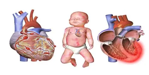 कावासाकी रोग (Kawasaki Disease - हृदय की रक्त वाहिकाओं में सूजन)