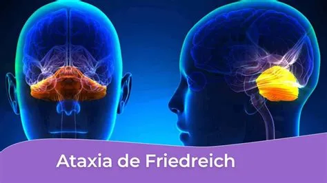 फ्रेडरिक अटाक्सिया (Friedreich's Ataxia)