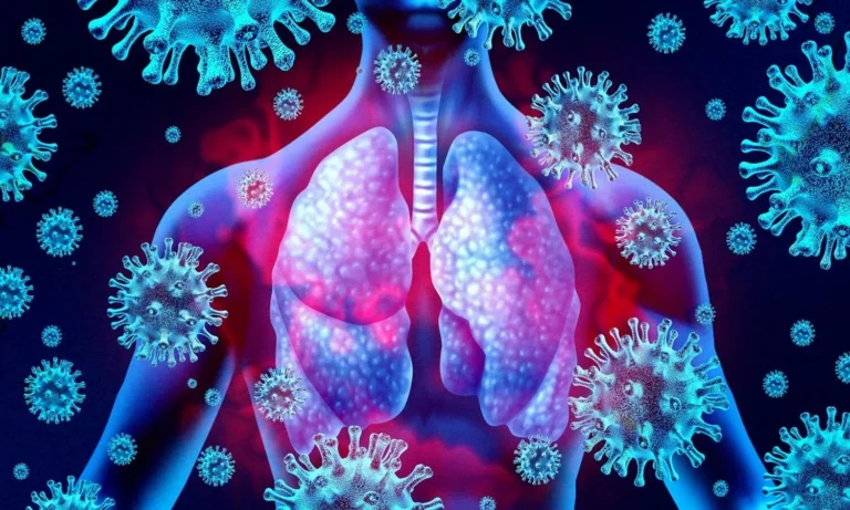 रेस्पिरेटरी सिंकाइटियल वायरस संक्रमण (RSV Infection)