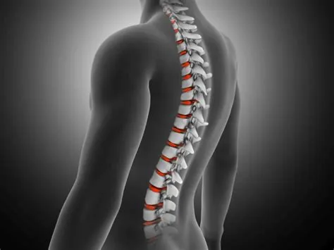 सिरिंगोमीलिया (Syringomyelia - रीढ़ की हड्डी में तरल पदार्थ की थैली)