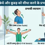 आगे झुके कंधे और कूबड़