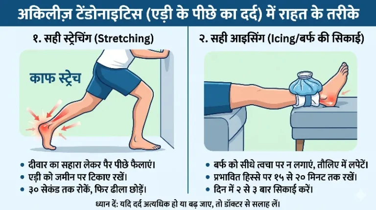 एड़ी के पीछे नस में दर्द