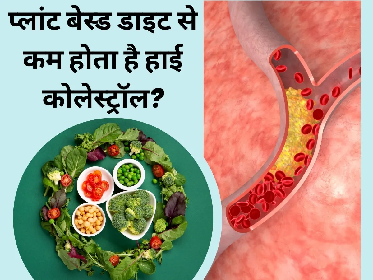 कोलेस्ट्रॉल (High Cholesterol) कम करने के लिए कितनी देर और कौन सी एक्सरसाइज करें?