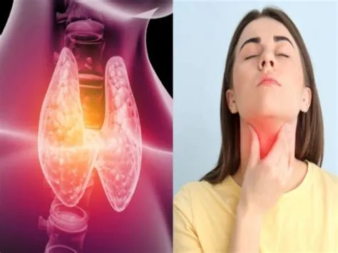 थायराइड (Hypothyroidism)