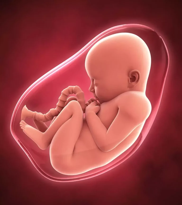 पॉलीहाइड्रामनिओस (Polyhydramnios - एमनियोटिक द्रव की अधिकता)